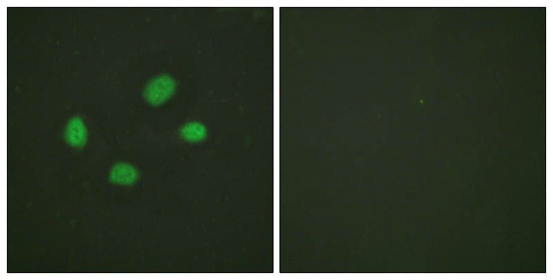 Chk2 (Phospho-Thr383) Rabbit Polyclonal Antibody, 100 ug