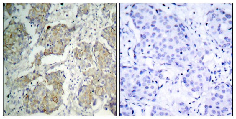 VEGFR2 (Phospho-Tyr1214) Rabbit Polyclonal Antibody, 100 ug