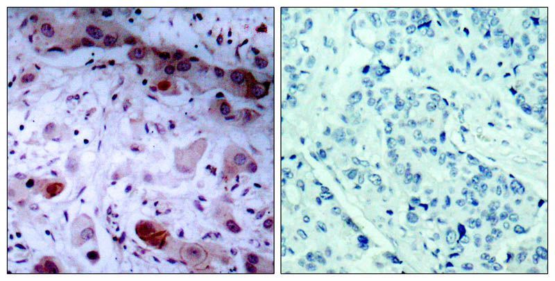 JAK1 (Phospho-Tyr1022) Rabbit Polyclonal Antibody, 100 ug