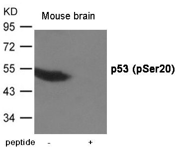 p53 (Phospho-Ser20) Rabbit Polyclonal Antibody, 100 ug