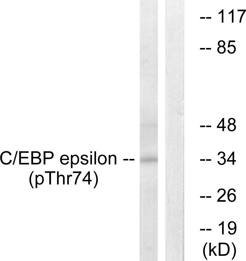 C/EBP-ε (Phospho-Thr74) Rabbit Polyclonal Antibody, 100 ug