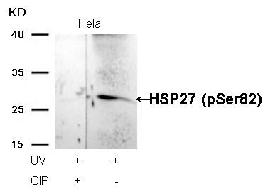 HSP27 (Phospho-Ser82) Rabbit Polyclonal Antibody, 100 ug
