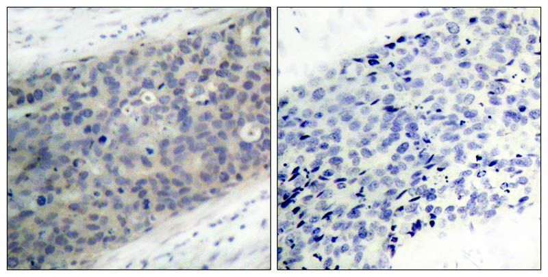 LIMK2 (Phospho-Thr505) Rabbit Polyclonal Antibody, 100 ug