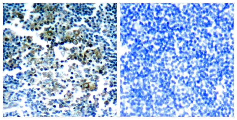 Bcr (Phospho-Tyr177) Rabbit Polyclonal Antibody, 100 ug