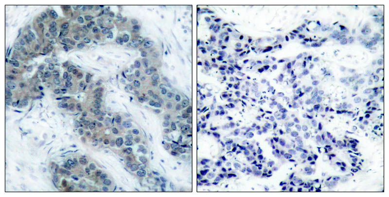 JAK2 (Phospho-Tyr1007) Rabbit Polyclonal Antibody, 100 ug