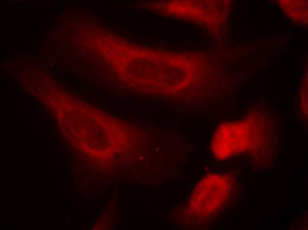 STAT1 (Phospho-Ser727) Rabbit Polyclonal Antibody, 100 ug