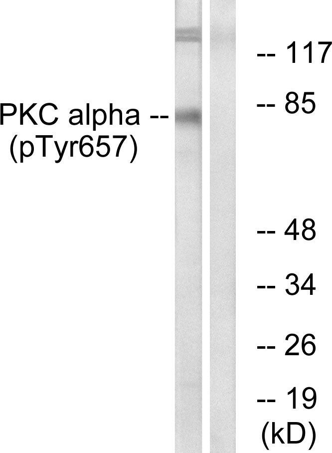 PKC α (Phospho-Tyr658) Rabbit Polyclonal Antibody, 100 ug