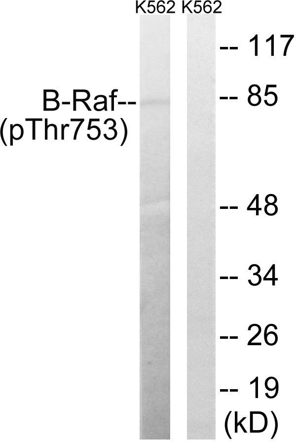 B-Raf (Phospho-Thr753) Rabbit Polyclonal Antibody, 100 ug
