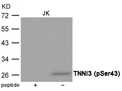 TNNI3 (Phospho-Ser43) Rabbit Polyclonal Antibody, 100 ug