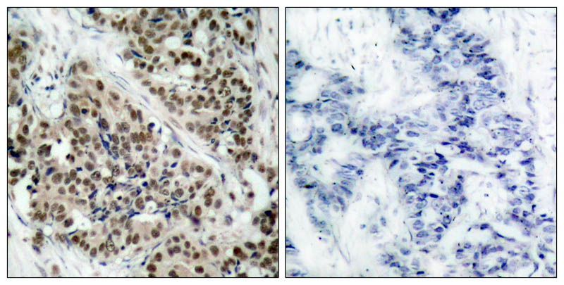 FKHR (Phospho-Ser256) Rabbit Polyclonal Antibody, 100 ug