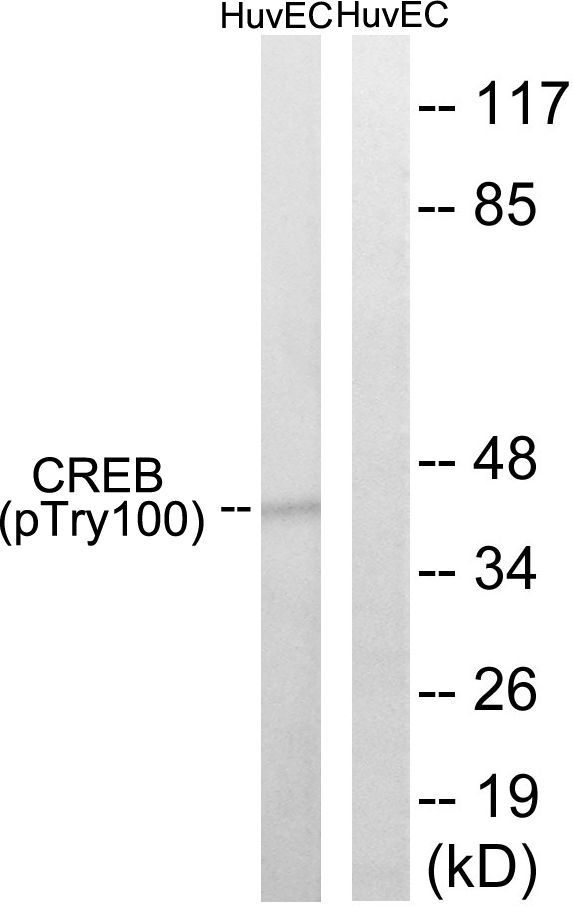 CREB (Phospho-Thr100) Rabbit Polyclonal Antibody, 100 ug