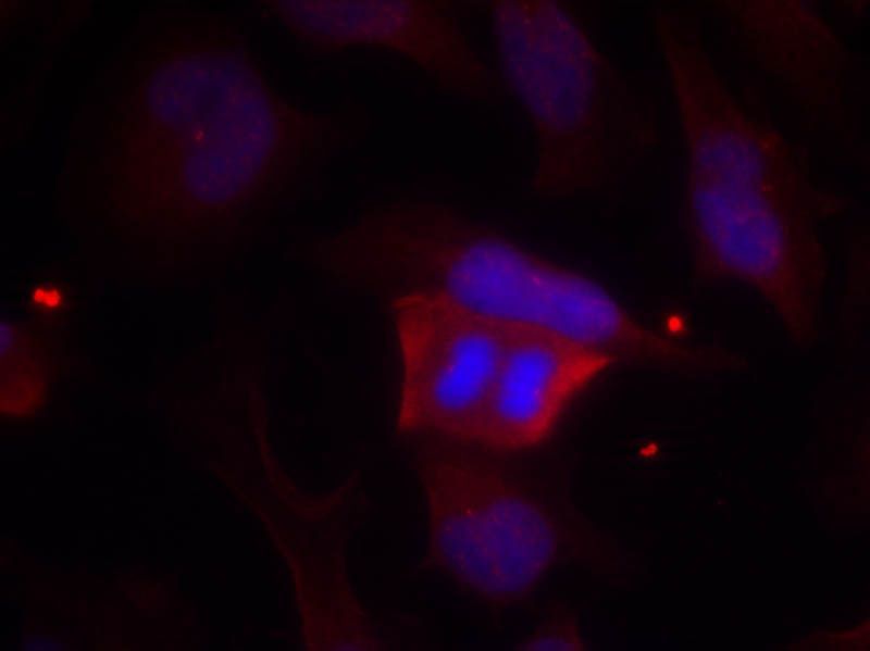 DARPP-32 (Phospho-Thr75) Rabbit Polyclonal Antibody, 100 ug