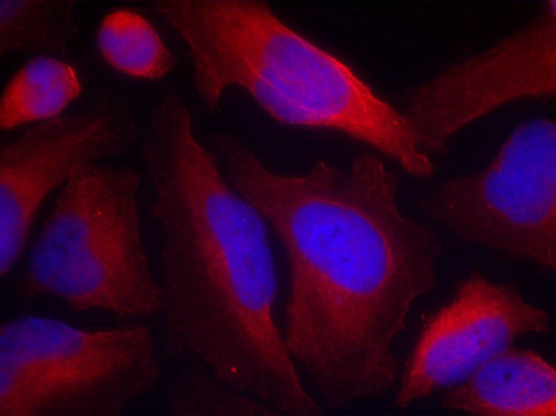 Tyrosine Hydroxylase (Phospho-Ser19) Rabbit Polyclonal Antibody, 100 ug