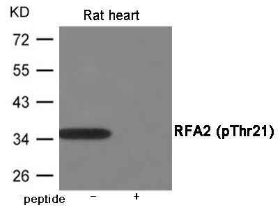 RFA2 (Phospho-Thr21) Rabbit Polyclonal Antibody, 100 ug