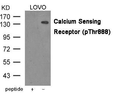 Calcium Sensing Receptor (Phospho-Thr888) Rabbit Polyclonal Antibody, 100 ug