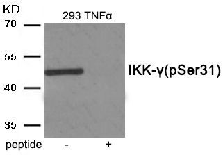 IKK- gamma (Phospho-Ser31) Rabbit Polyclonal Antibody, 100 ug