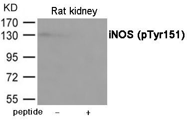 iNOS (Phospho-Tyr151) Rabbit Polyclonal Antibody, 100 ug