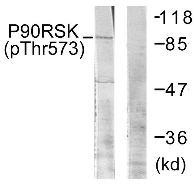 p90 RSK (Phospho-Thr573) Rabbit Polyclonal Antibody, 100 ug