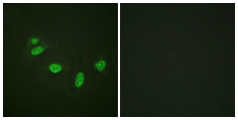 ETS1 (Phospho-Thr38) Rabbit Polyclonal Antibody, 100 ug