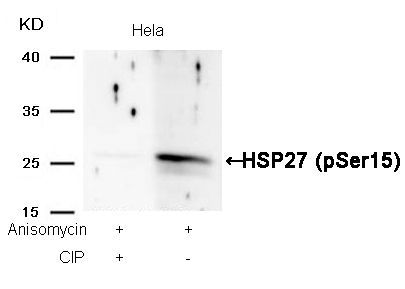 HSP27 (Phospho-Ser15) Rabbit Polyclonal Antibody, 100 ug