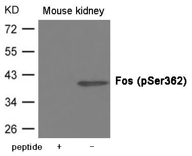 Fos (Phospho-Ser362) Rabbit Polyclonal Antibody, 100 ug