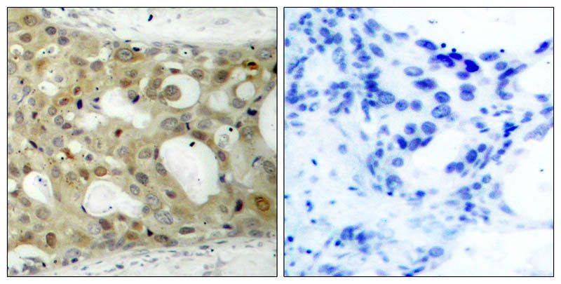 Androgen Receptor (Phospho-Ser650) Rabbit Polyclonal Antibody, 100 ug