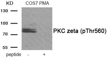 PKC zeta (Phospho-Thr560) Rabbit Polyclonal Antibody, 100 ug