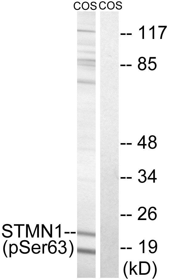 STMN1 (Phospho-Ser63) Rabbit Polyclonal Antibody, 100 ug