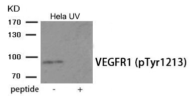 VEGFR1 (Phospho-Tyr1213) Rabbit Polyclonal Antibody, 100 ug