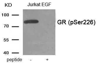 GR (Phospho-Ser226) Rabbit Polyclonal Antibody, 100 ug