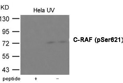 C-RAF (Phospho-Ser621) Rabbit Polyclonal Antibody, 100 ug