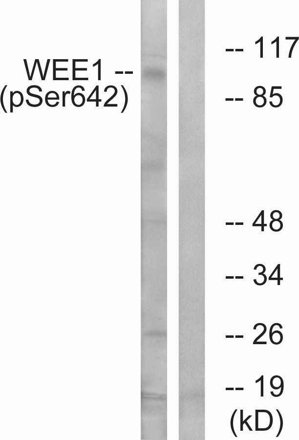 TISB (Phospho-Ser92) Rabbit Polyclonal Antibody, 100 ug