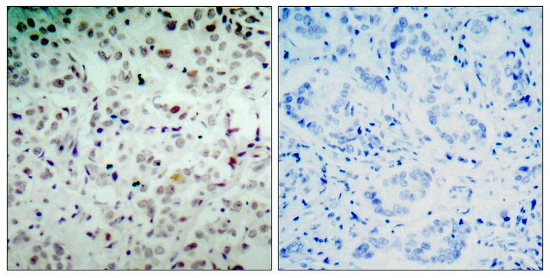 Rb (Phospho-Ser780) Rabbit Polyclonal Antibody, 100 ug