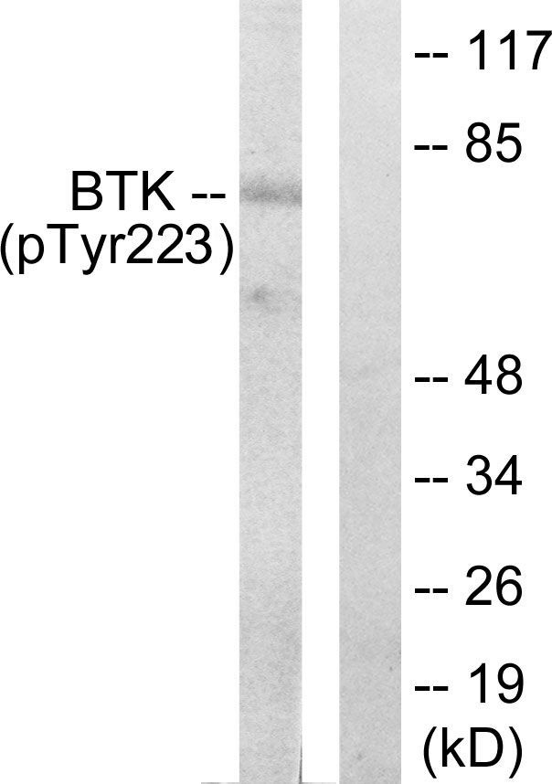 BTK (Phospho-Tyr223) Rabbit Polyclonal Antibody, 100 ug