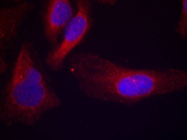 c-Cbl (phospho-Tyr700) Rabbit Polyclonal Antibody, 100 ug