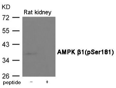 AMPK β1(Phospho-Ser181) Rabbit Polyclonal Antibody, 100 ug