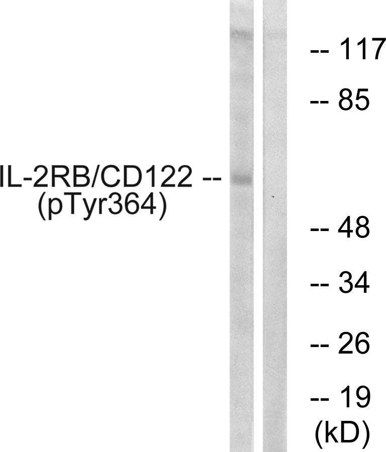 IL-2Rβ/CD122 (Phospho-Tyr364) Rabbit Polyclonal Antibody, 100 ug