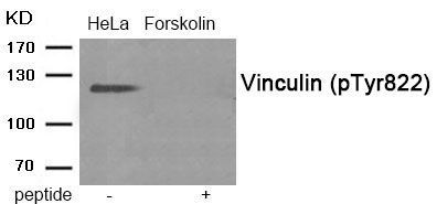 Vinculin (Phospho-Tyr822) Rabbit Polyclonal Antibody, 100 ug
