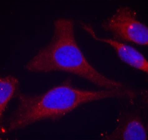 SHP-1 (Phospho-Tyr536) Rabbit Polyclonal Antibody, 100 ug