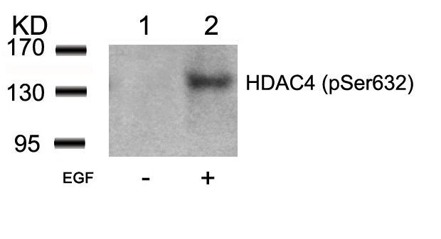 HDAC4 (Phospho-Ser632) Rabbit Polyclonal Antibody, 100 ug