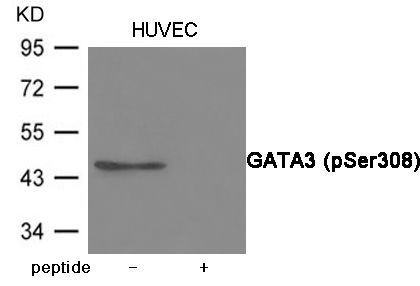 GATA3 (Phospho-Ser308) Rabbit Polyclonal Antibody, 100 ug