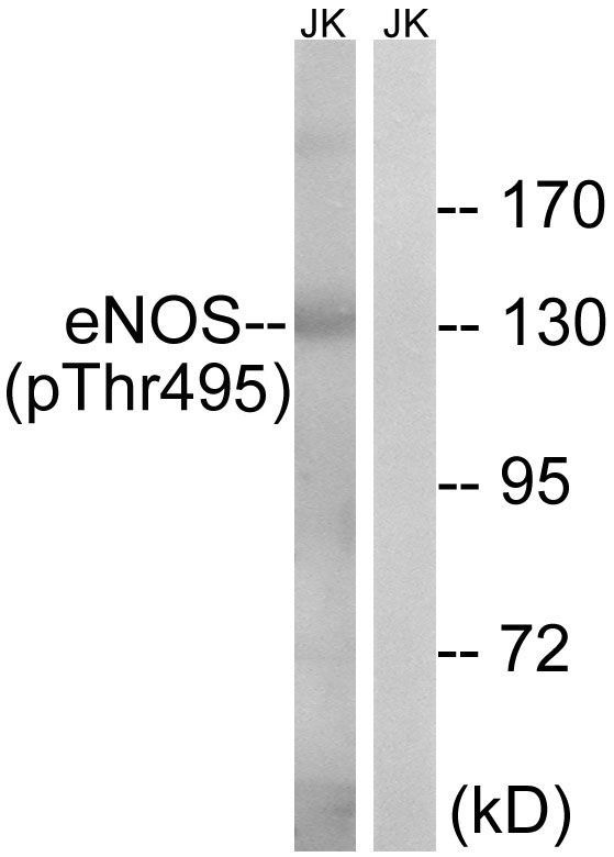 eNOS (Phospho-Thr495) Rabbit Polyclonal Antibody, 100 ug