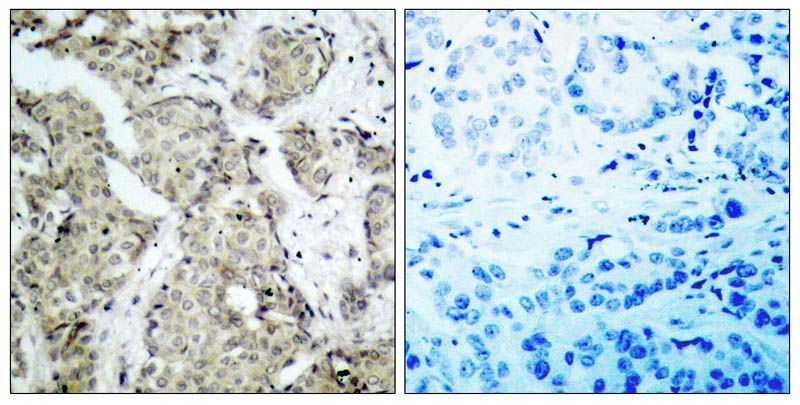 MKK6 (Phospho-Ser207) Rabbit Polyclonal Antibody, 100 ug