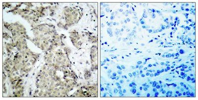 MKK6 (Phospho-Ser207) Rabbit Polyclonal Antibody, 100 ug