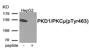 PKD1/PKC μ (Phospho-Tyr463) Rabbit Polyclonal Antibody, 100 ug