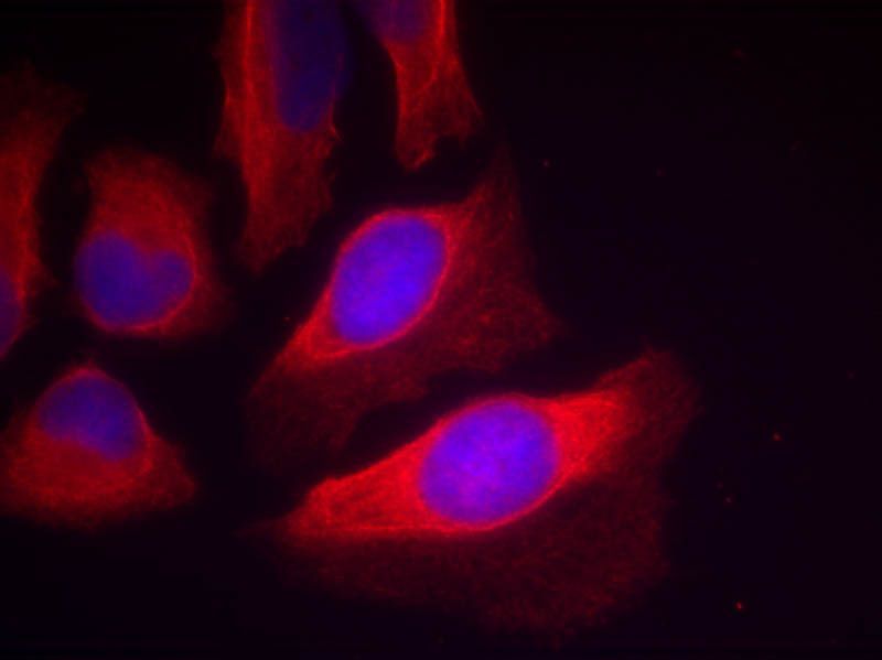IKK-β(Phospho-Tyr199) Rabbit Polyclonal Antibody, 100 ug
