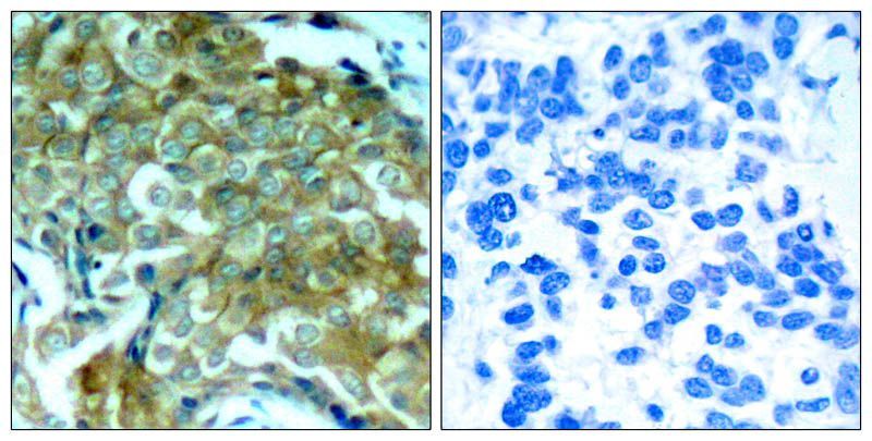 EGFR (Phospho-Tyr1172) Rabbit Polyclonal Antibody, 100 ug