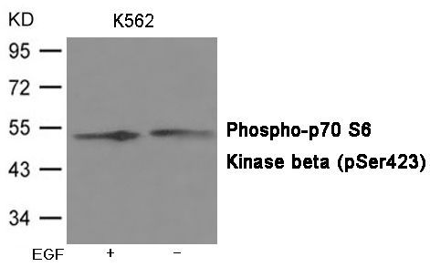 p70 S6 Kinase beta (Phospho-Ser423) Rabbit Polyclonal Antibody, 100 ug
