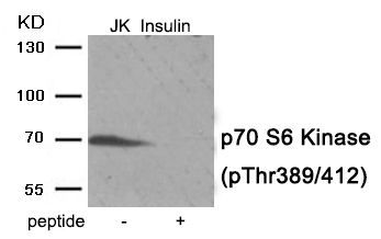 p70 S6 Kinase (Phospho-Thr389/412) Rabbit Polyclonal Antibody, 100 ug