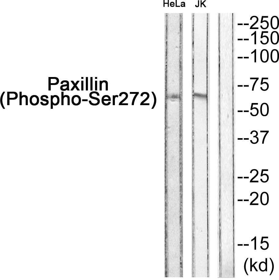 Paxillin (Phospho-Ser272) Rabbit Polyclonal Antibody, 100 ug